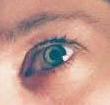 eye